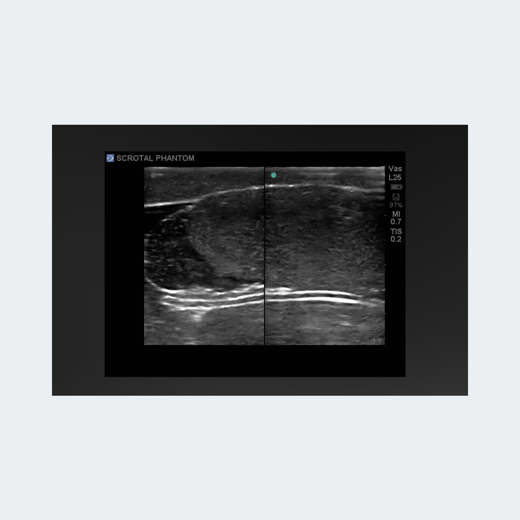 Blue Phantom Scrotal Ultrasound Training Model