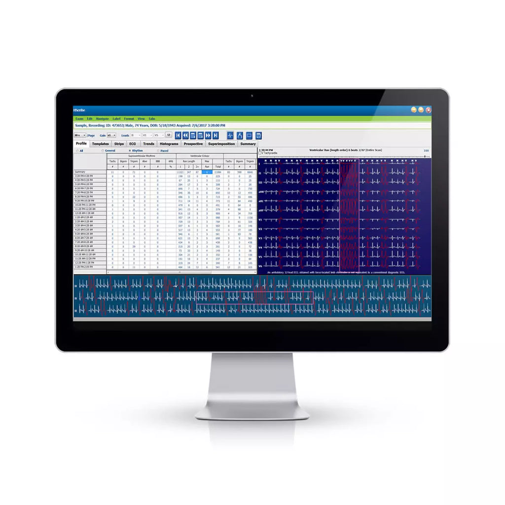 Hscribe Holter Analysis System, Version 6, with Adult & Pediatric Arrhythmia Analysis, DICOM