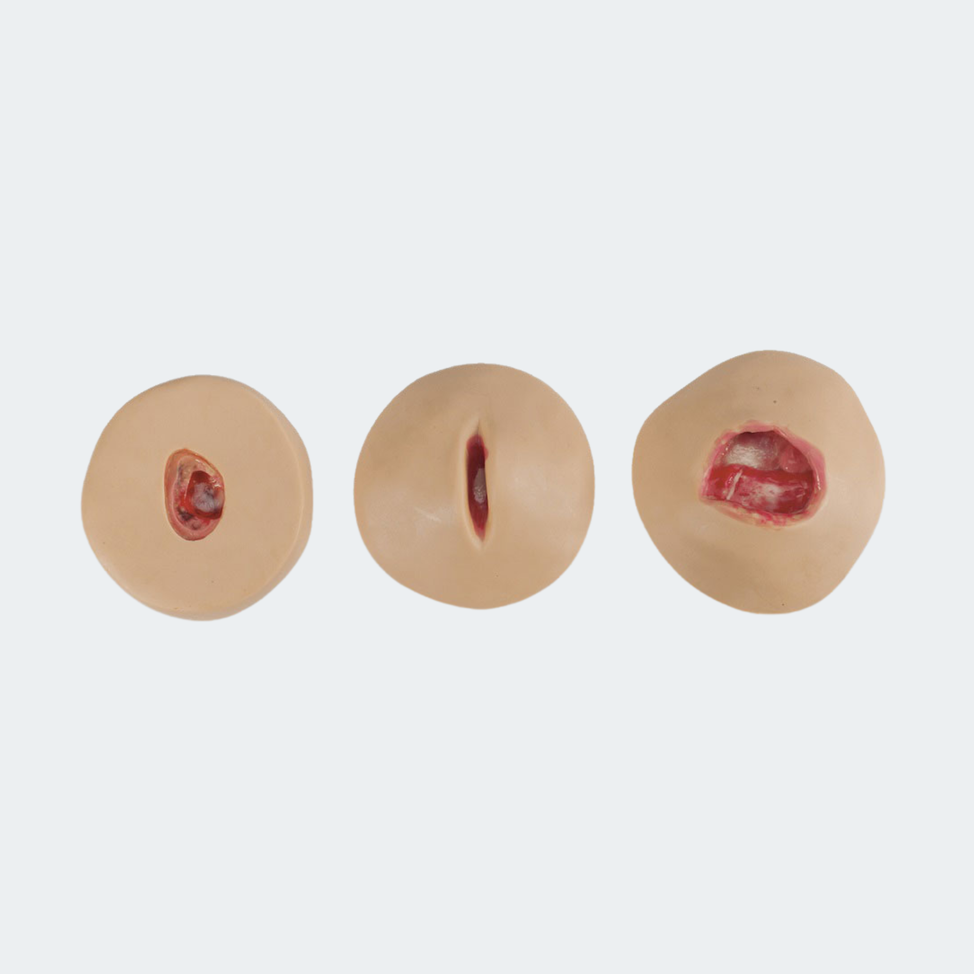Life/form Negative-Pressure Wound Therapy (NPWT) Trainers Part #: LF00948U